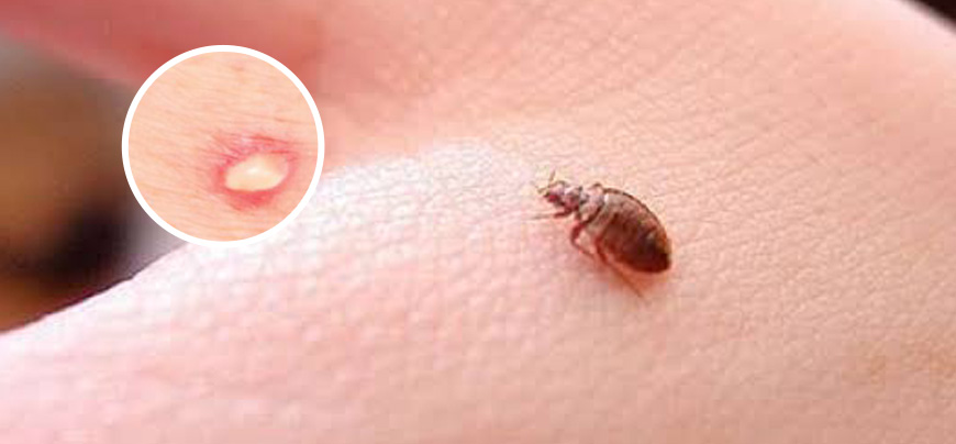 Bed Bugs Control Melbourne | Bed Bugs Treatment | ☎0448 955 555