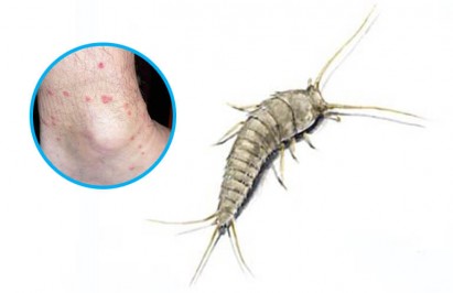 silverfish pest control melbourne